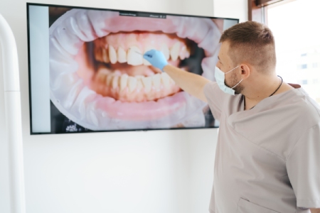 Dentysta pokazujący na ekranie zdjęcie zębów pacjenta – analiza stanu jamy ustnej podczas przeglądu